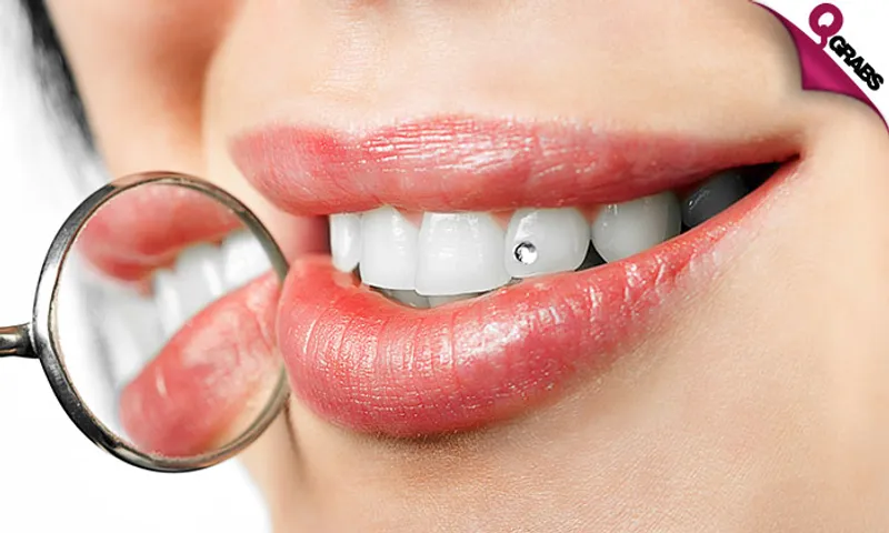 Dental Jewelry & Tooth Filling with X-Ray + Consultation!